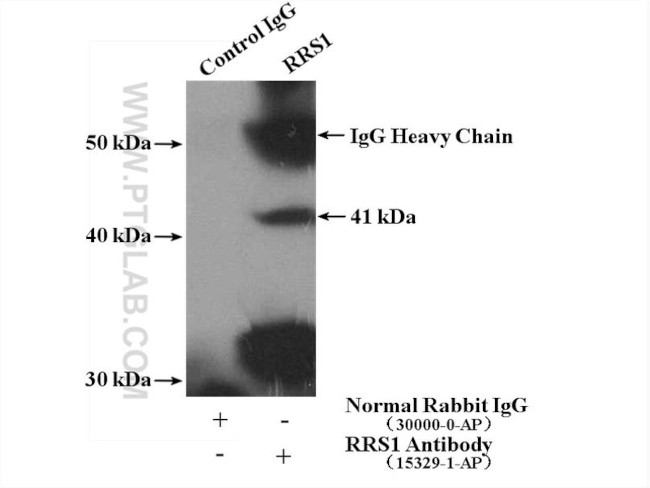 RRS1 Antibody in Immunoprecipitation (IP)