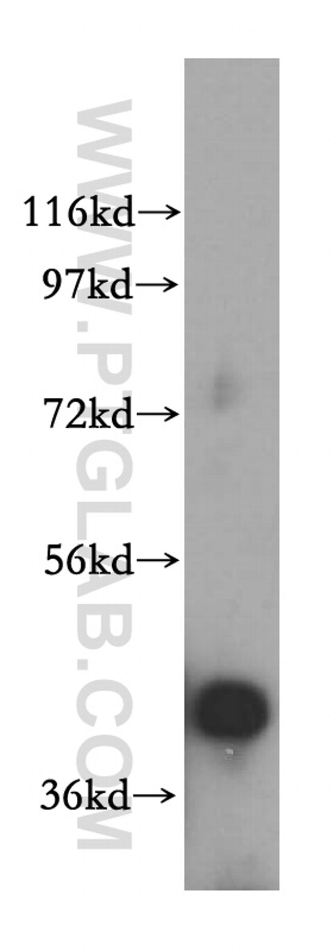 RRS1 Antibody in Western Blot (WB)