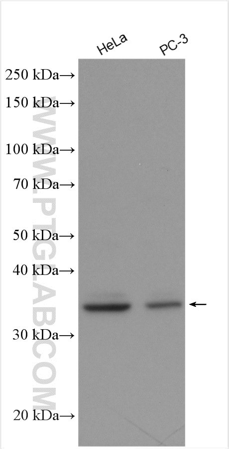 BRCC3 Antibody in Western Blot (WB)