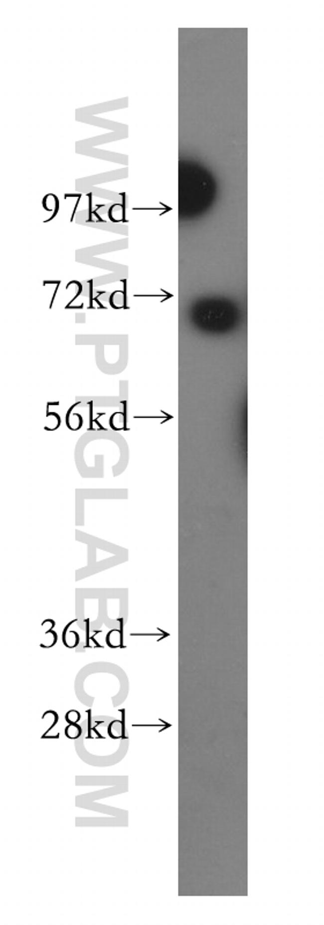 BRCC3 Antibody in Western Blot (WB)