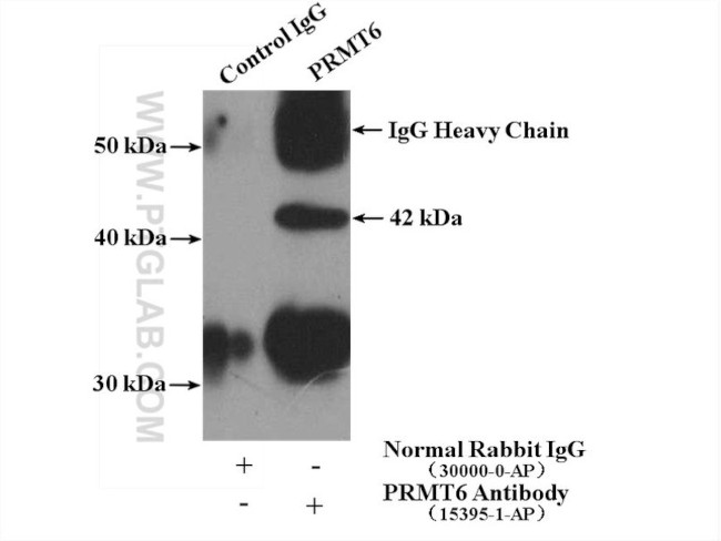 PRMT6 Antibody in Immunoprecipitation (IP)