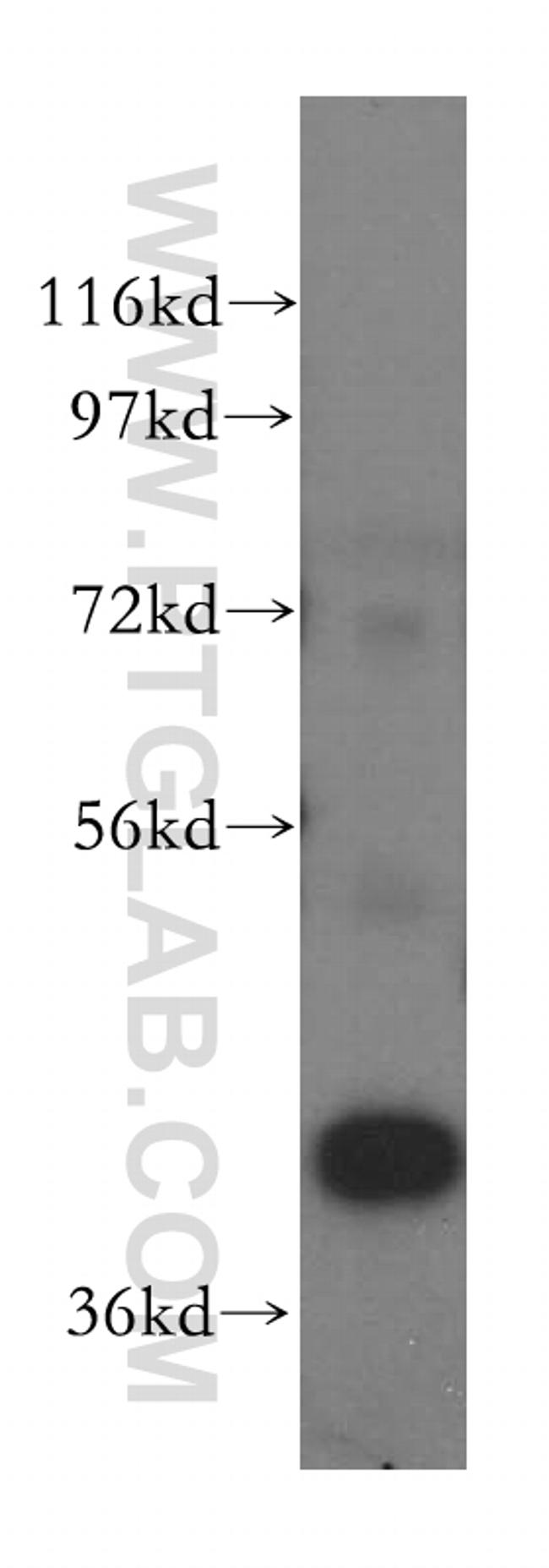 PRMT6 Antibody in Western Blot (WB)