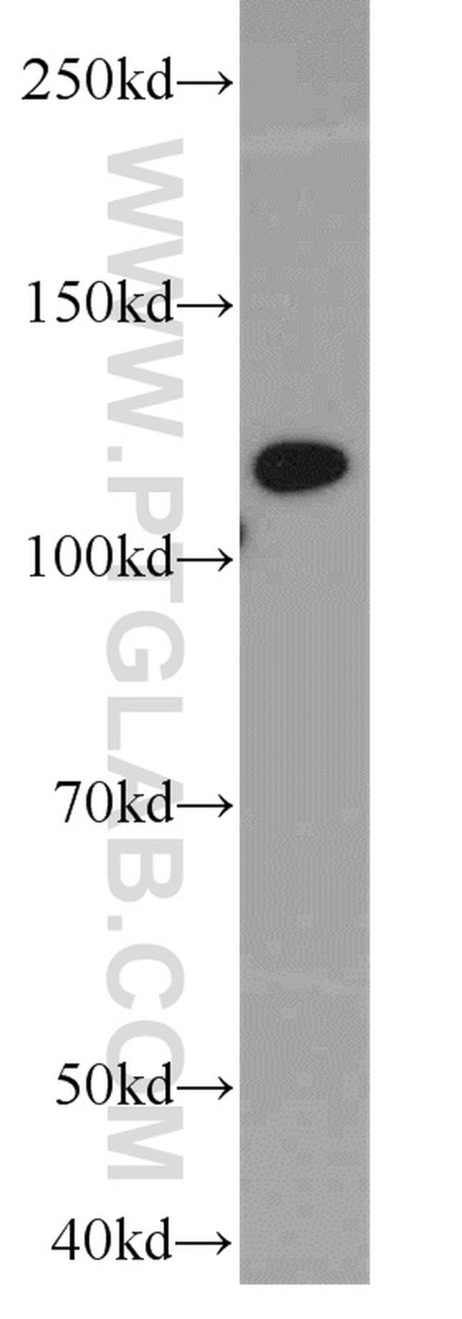 ATP citrate lyase Antibody in Western Blot (WB)