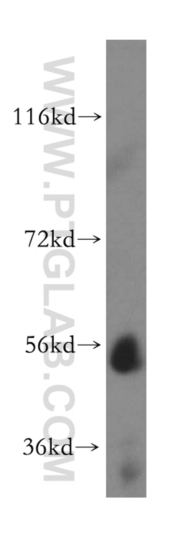 UGT2B4 Antibody in Western Blot (WB)