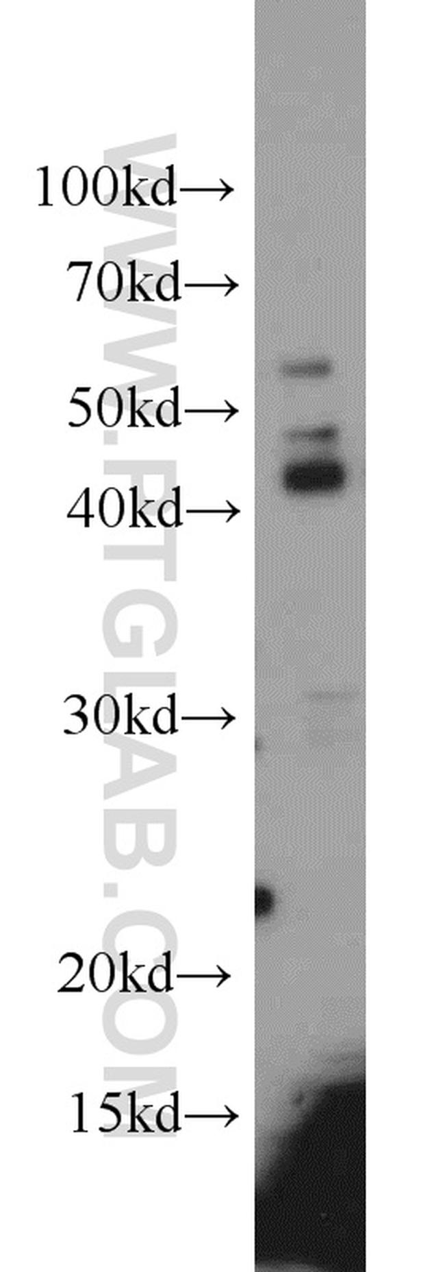 Alpha galactosidase A Antibody in Western Blot (WB)