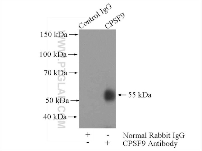 CPSF6 Antibody in Immunoprecipitation (IP)