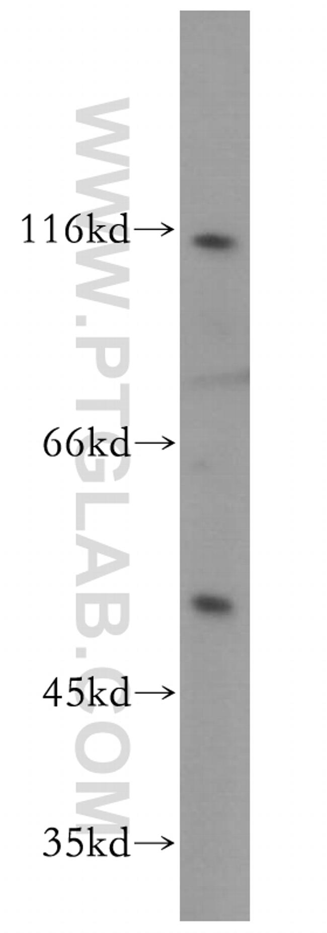 NFKB1 p105/p50 Antibody in Western Blot (WB)