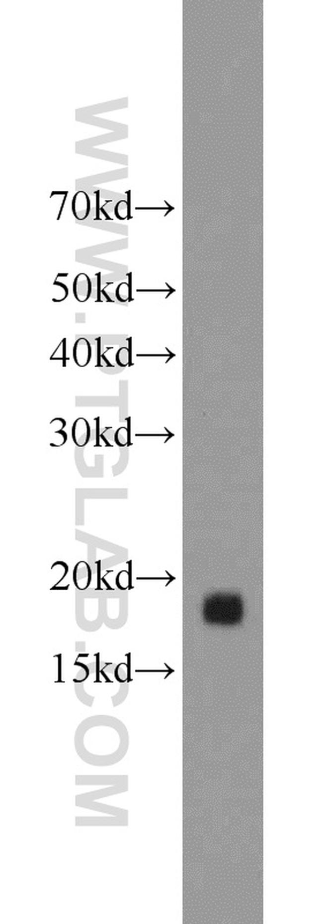 MRPL49 Antibody in Western Blot (WB)