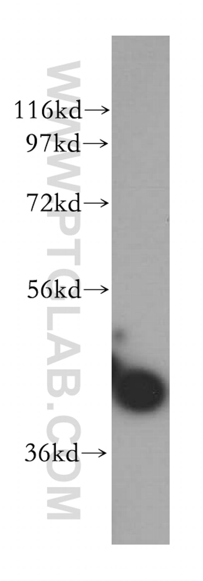 UROD Antibody in Western Blot (WB)