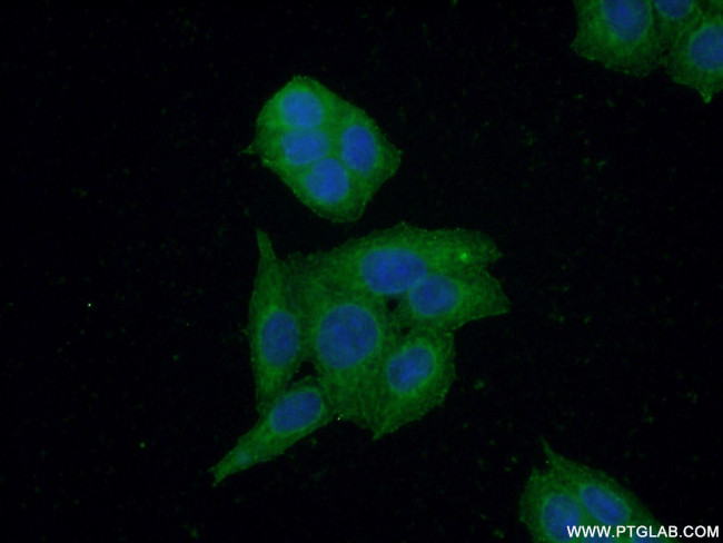 CBR3 Antibody in Immunocytochemistry (ICC/IF)