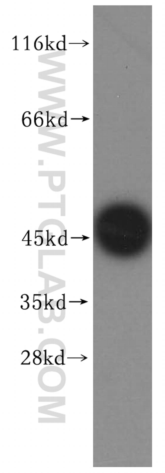 Carboxypeptidase A2 Antibody in Western Blot (WB)