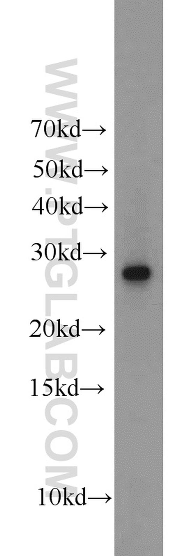 EXOSC5 Antibody in Western Blot (WB)