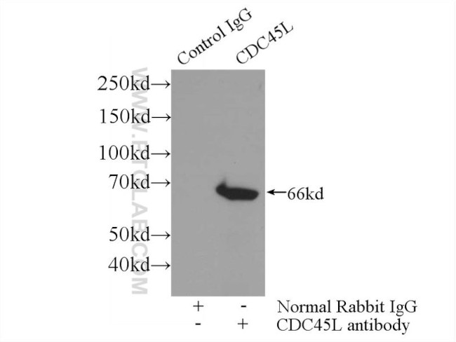 CDC45L Antibody in Immunoprecipitation (IP)