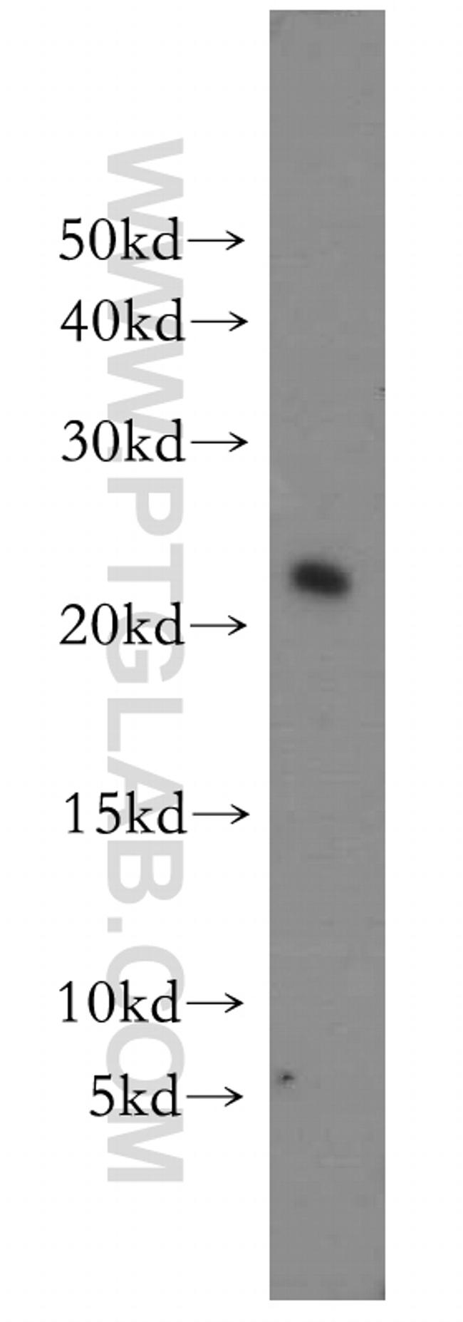 UBE2H Antibody in Western Blot (WB)