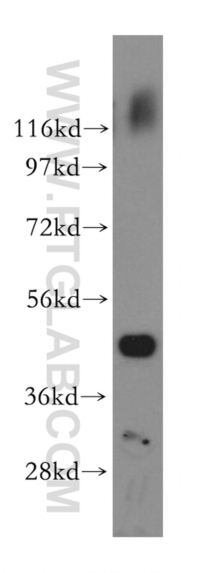 ATXN10 Antibody in Western Blot (WB)