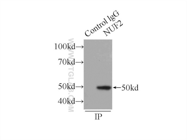 NUF2 Antibody in Immunoprecipitation (IP)