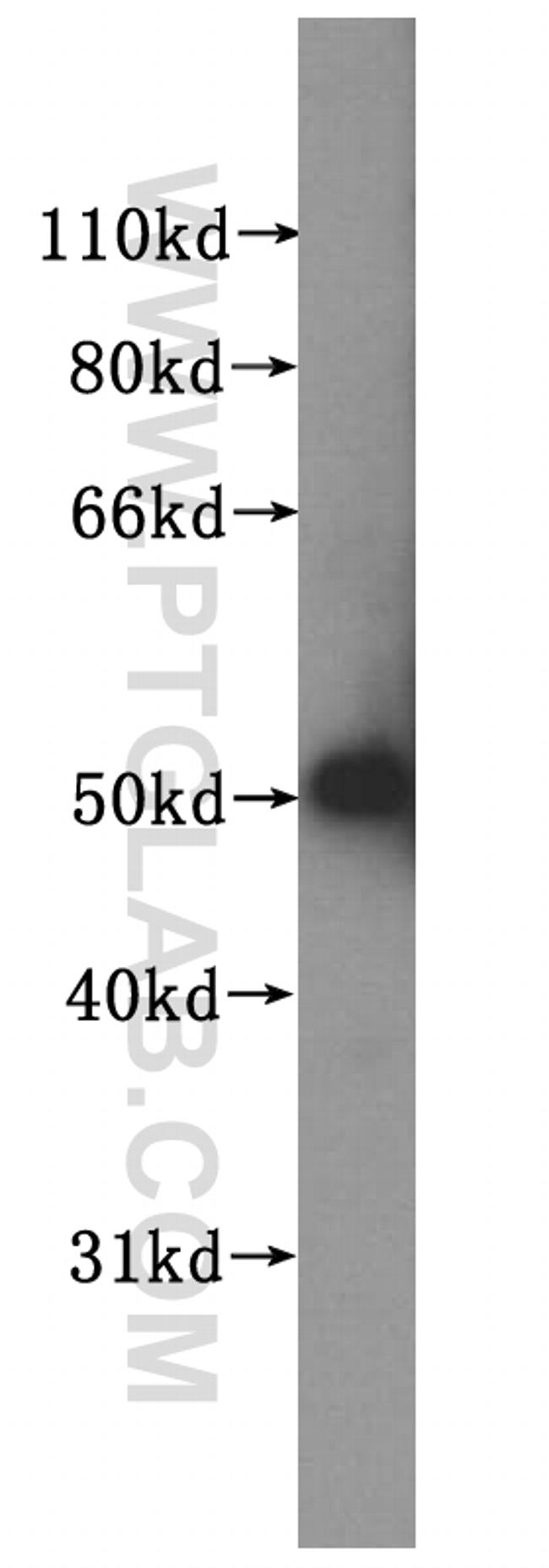 NUF2 Antibody in Western Blot (WB)