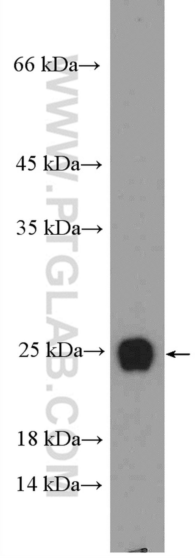 RPL29 Antibody in Western Blot (WB)