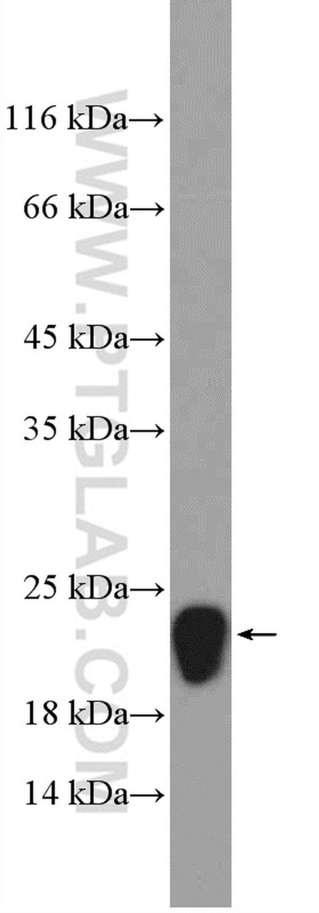 FXYD6 Antibody in Western Blot (WB)