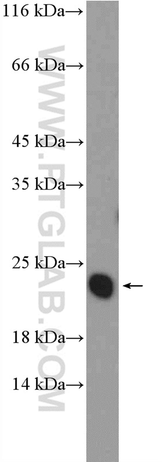 FXYD6 Antibody in Western Blot (WB)