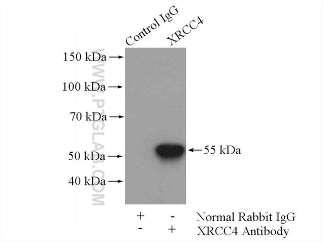 XRCC4 Antibody in Immunoprecipitation (IP)
