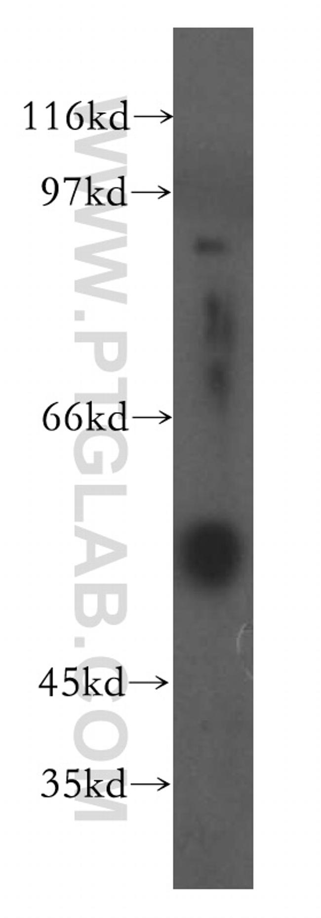 Fibrinogen gamma chain Antibody in Western Blot (WB)