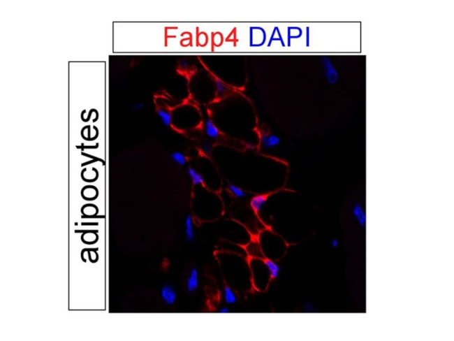 FABP4 Antibody in Immunohistochemistry (PFA fixed) (IHC (PFA))