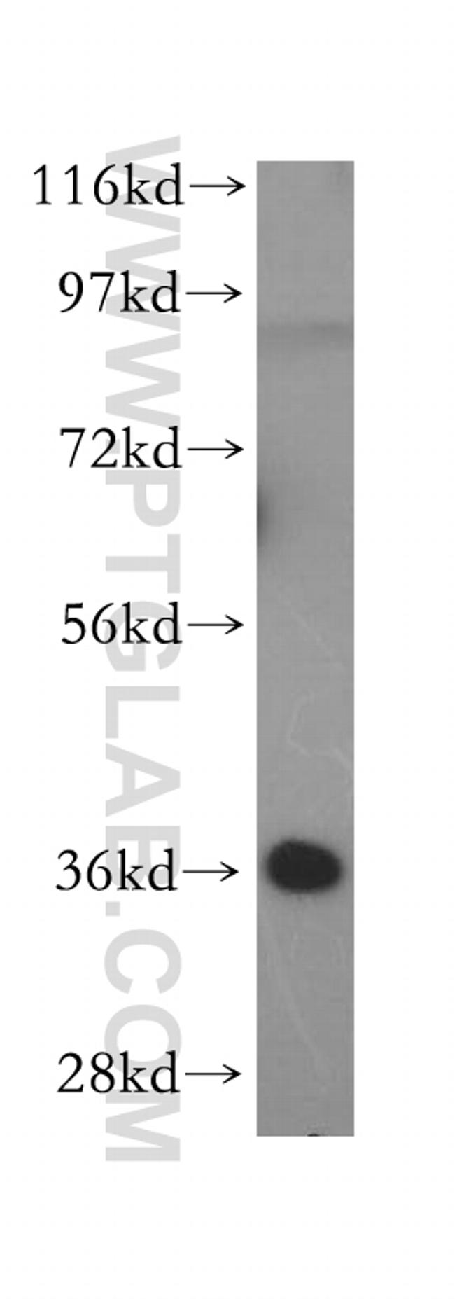 MDH1 Antibody in Western Blot (WB)