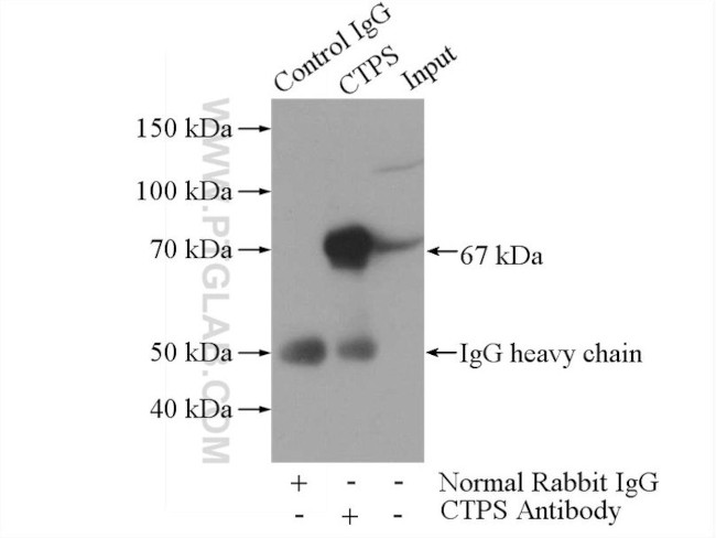 CTP synthase Antibody in Immunoprecipitation (IP)
