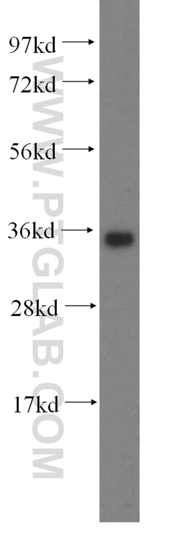 KCNJ15 Antibody in Western Blot (WB)