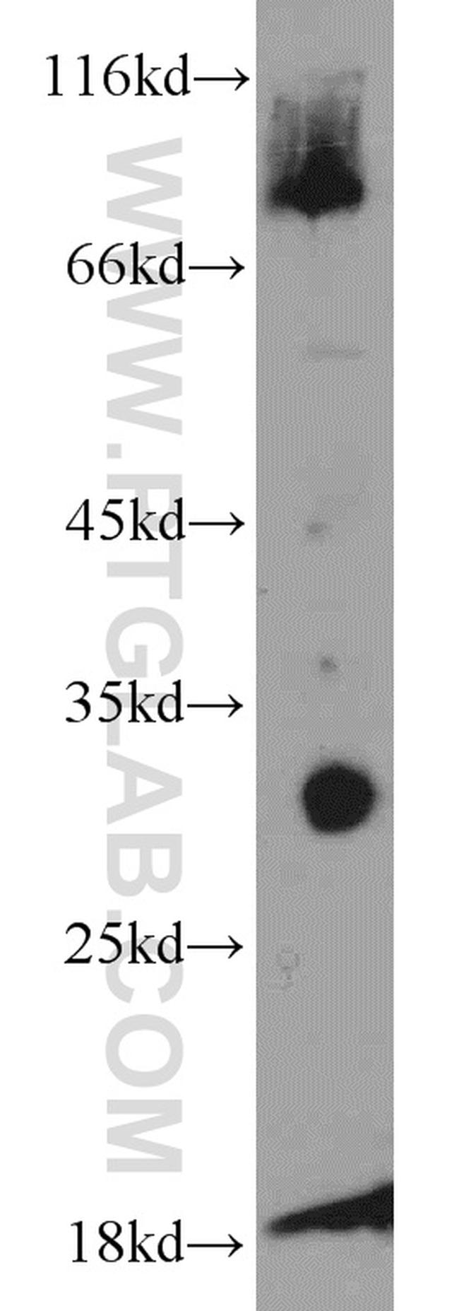 ANT1/2 Antibody in Western Blot (WB)