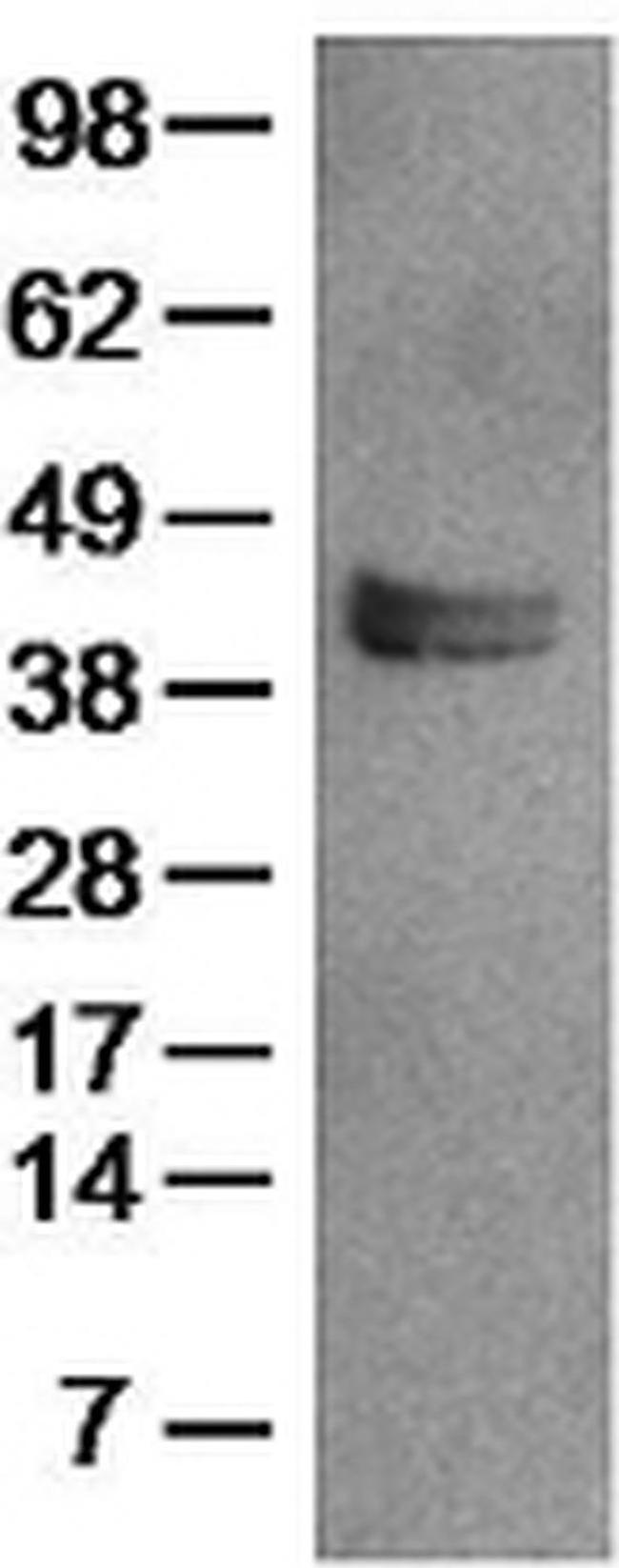 LAP (Latency Associated peptide) Antibody in Western Blot (WB)