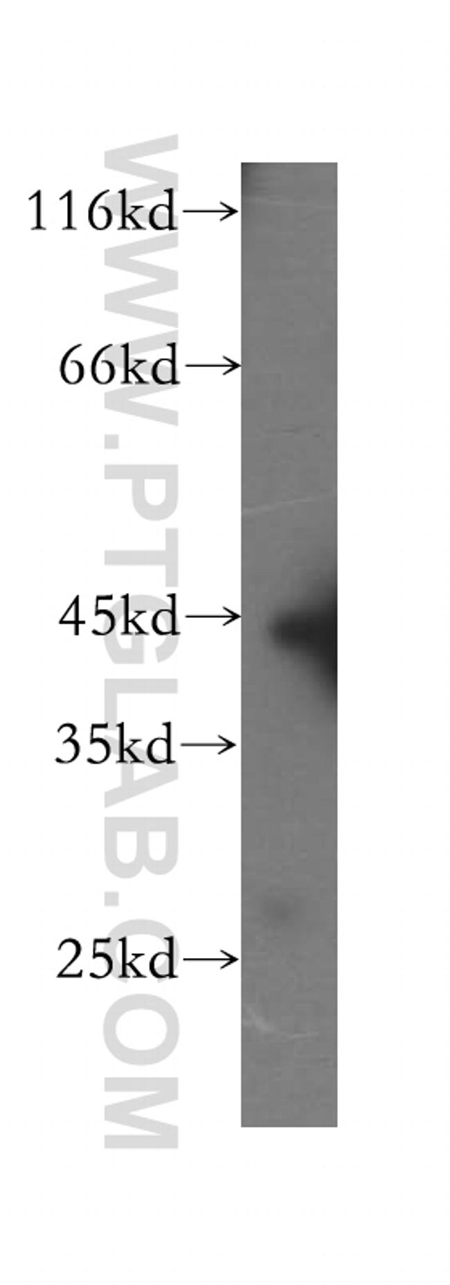 GTF2H2 Antibody in Western Blot (WB)