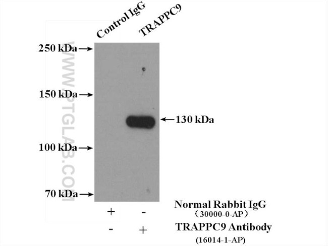 TRAPPC9 Antibody in Immunoprecipitation (IP)