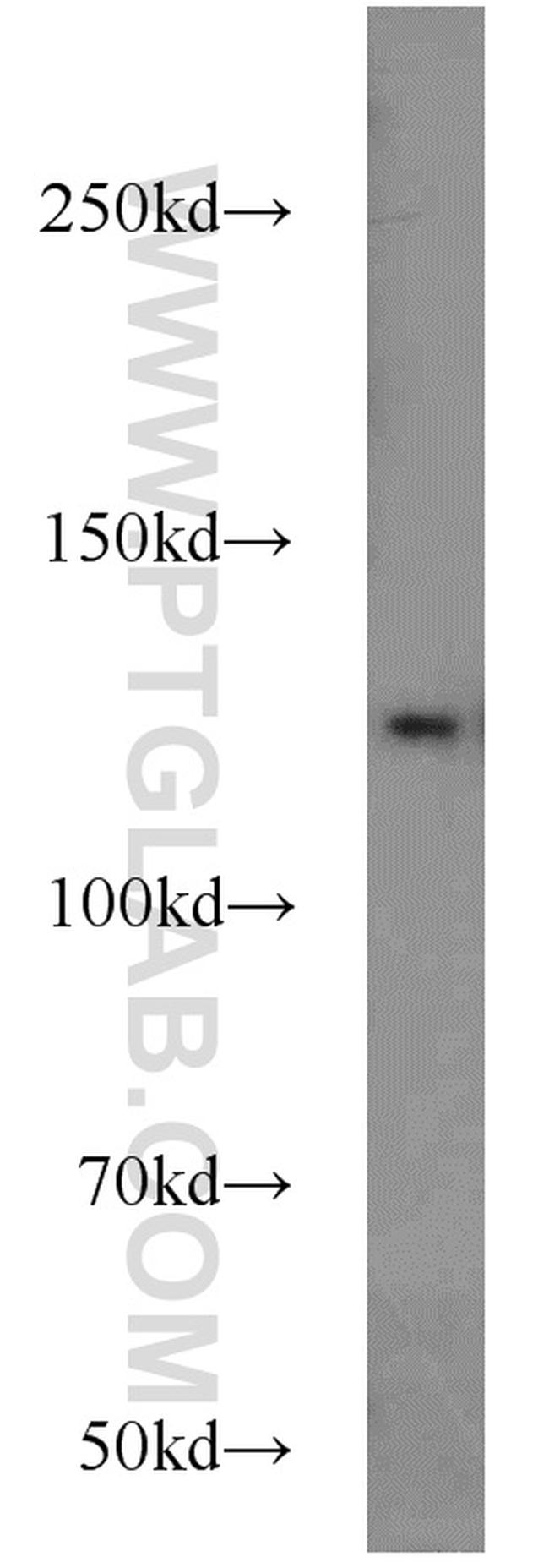 TRAPPC9 Antibody in Western Blot (WB)