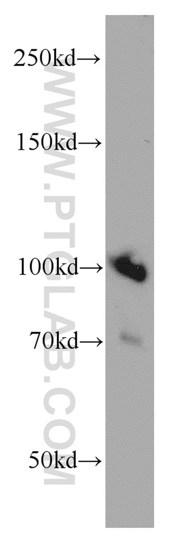 MMS19 Antibody in Western Blot (WB)