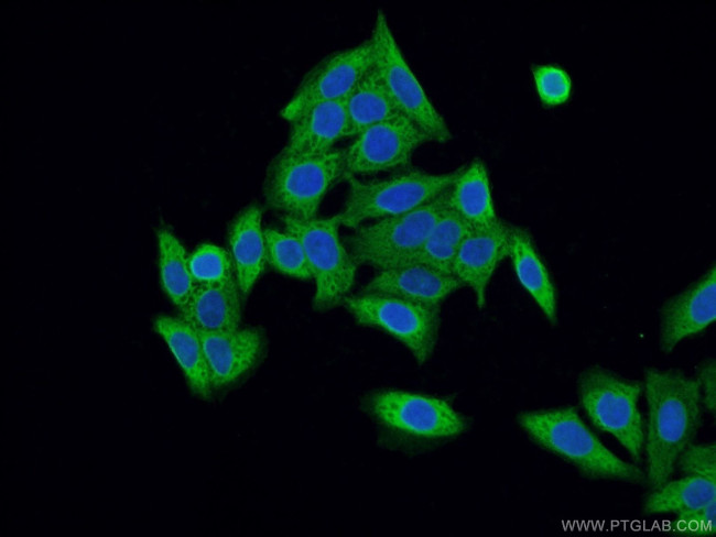SRP19 Antibody in Immunocytochemistry (ICC/IF)