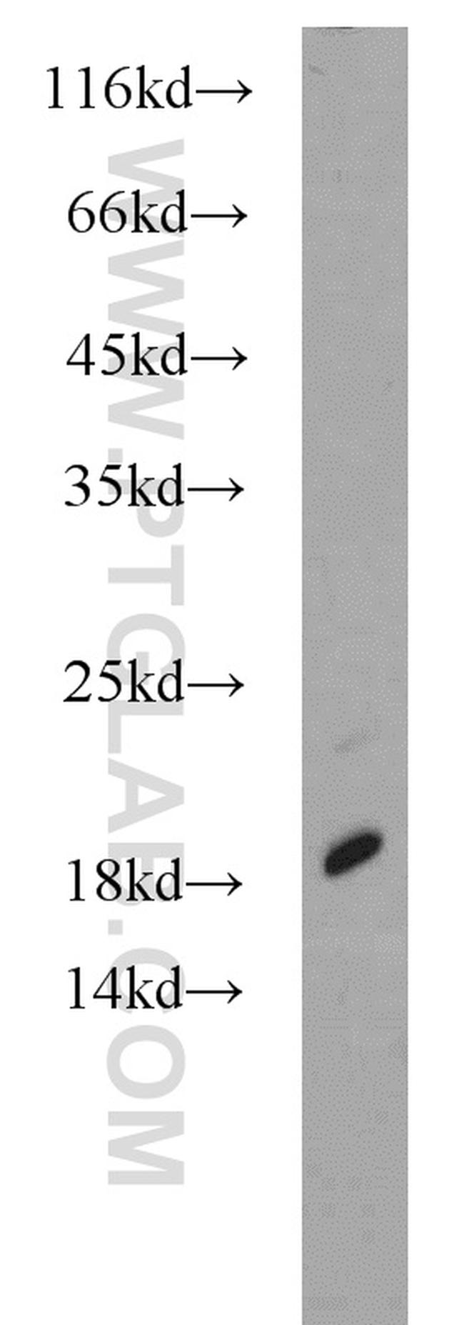 SRP19 Antibody in Western Blot (WB)