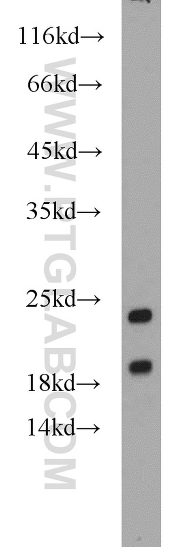 SRP19 Antibody in Western Blot (WB)
