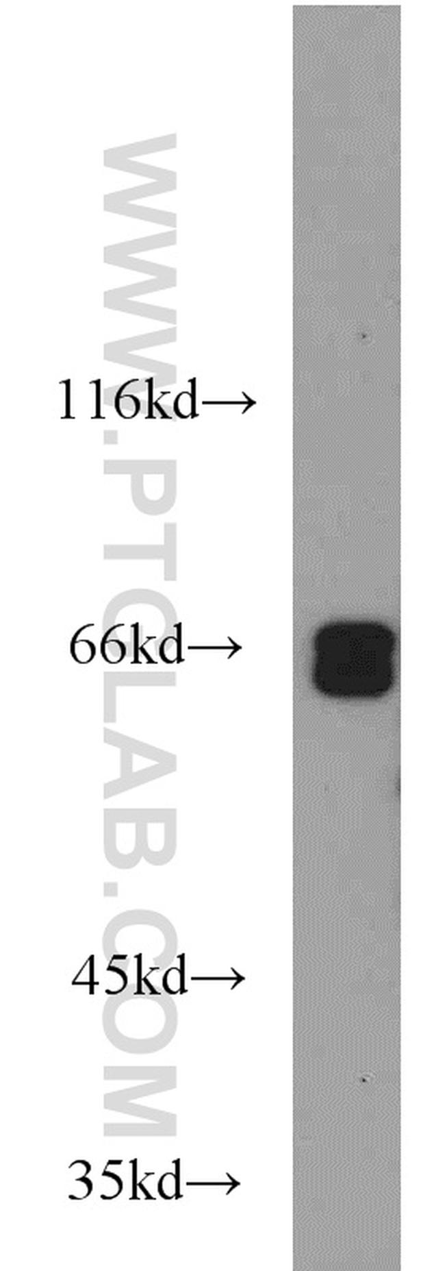 MYEF2 Antibody in Western Blot (WB)