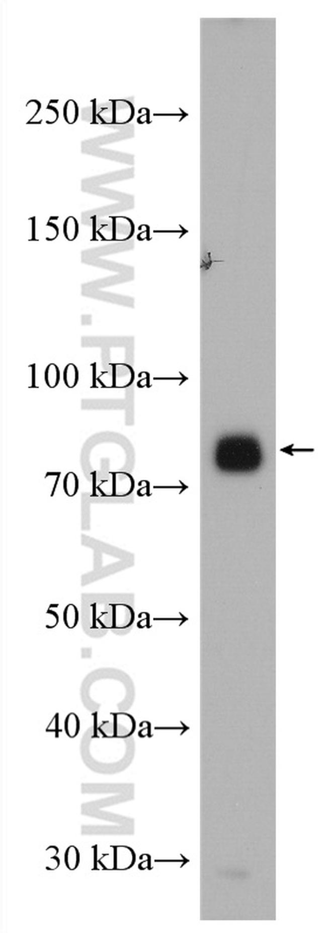 Acetyl CoA synthetase Antibody in Western Blot (WB)