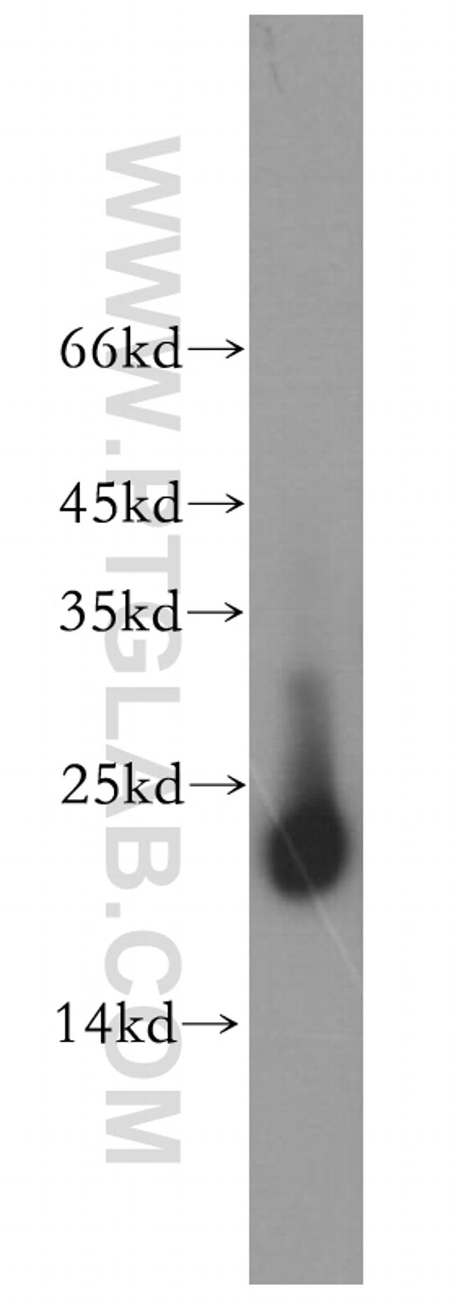 RAC1/2/3 Antibody in Western Blot (WB)