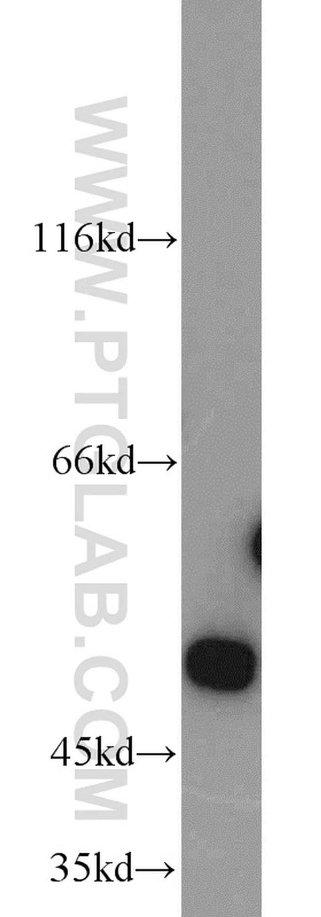 Citrate synthase Antibody in Western Blot (WB)
