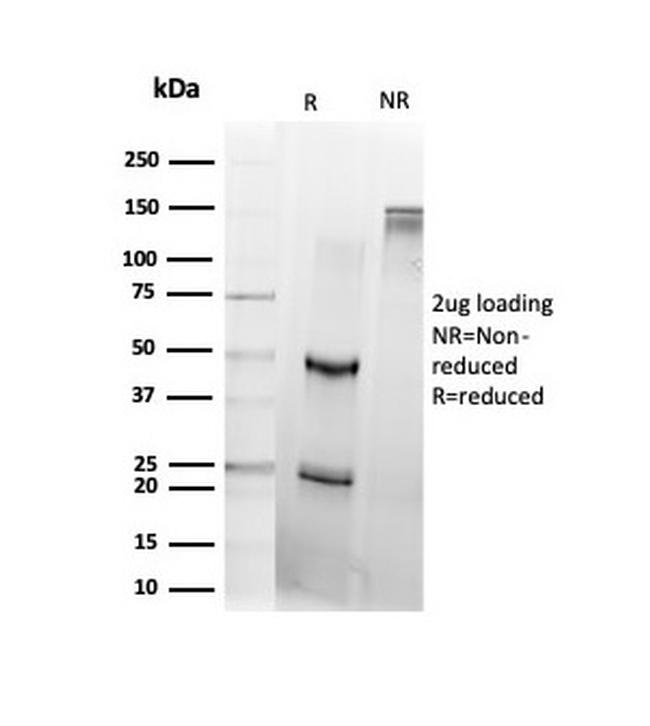DAXX Antibody in SDS-PAGE (SDS-PAGE)