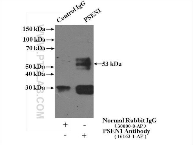 Presenilin-1 Antibody in Immunoprecipitation (IP)