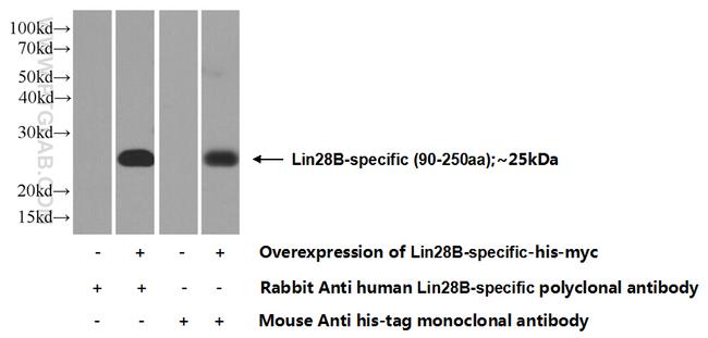 Lin28B Antibody in Western Blot (WB)