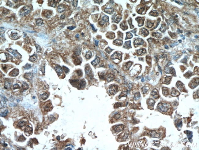 MCL1 Antibody in Immunohistochemistry (Paraffin) (IHC (P))