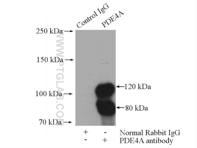 PDE4A Antibody in Immunoprecipitation (IP)