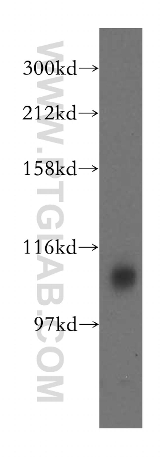 ATP13A1 Antibody in Western Blot (WB)