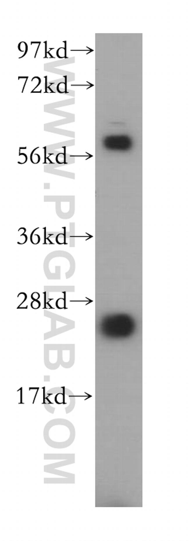 PSF2 Antibody in Western Blot (WB)